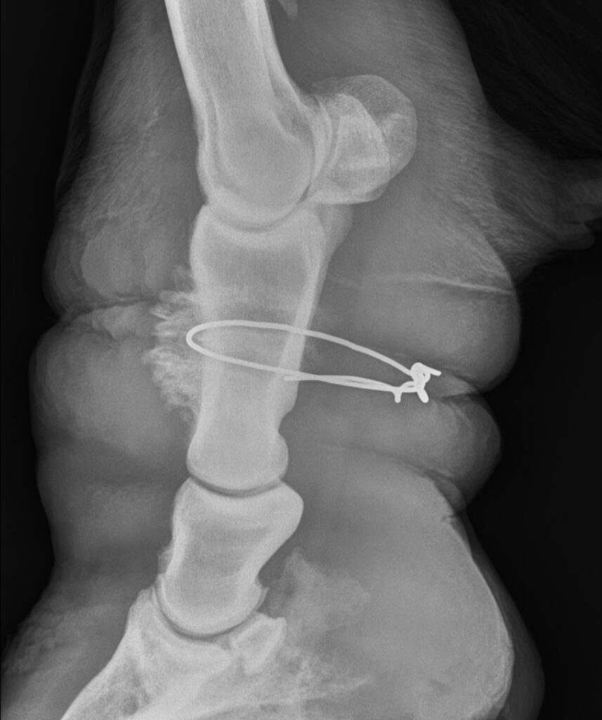 Radiograph of Zeke by Palm Beach Equine Clinic showing wire deeply embedded into pastern bone. 